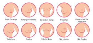 Breast cancer symptoms