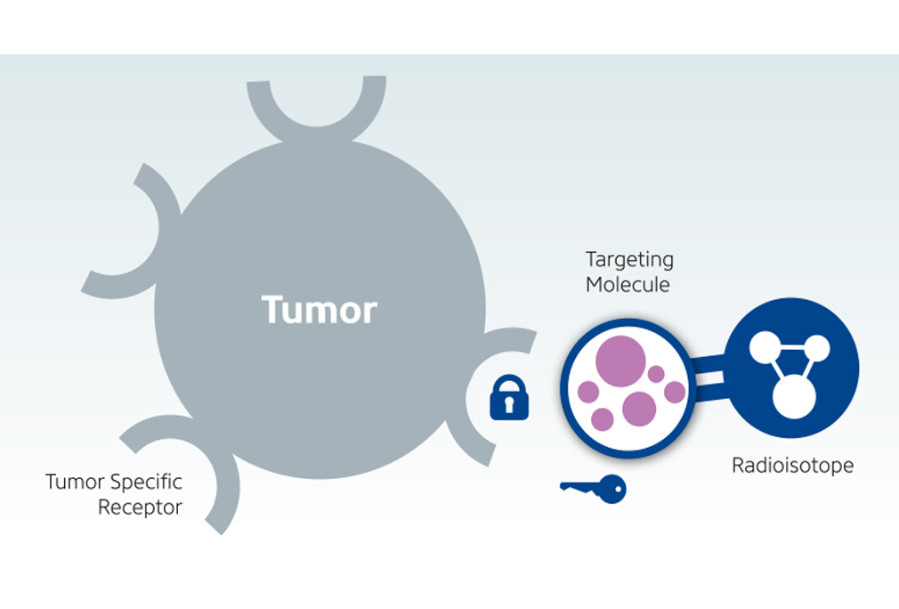 Leutetium-PSMA for Prostate Cancer