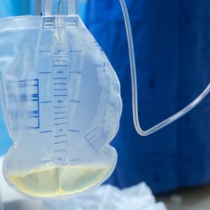 Protecting Cancer Patients with Urinary Catheters: 6 Ways to Prevent UTIs